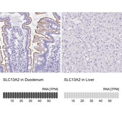 SLC13A2 Antibody, Novus Biologicals 0.1mL; Unlabeled:Antibodies, Polyclonal